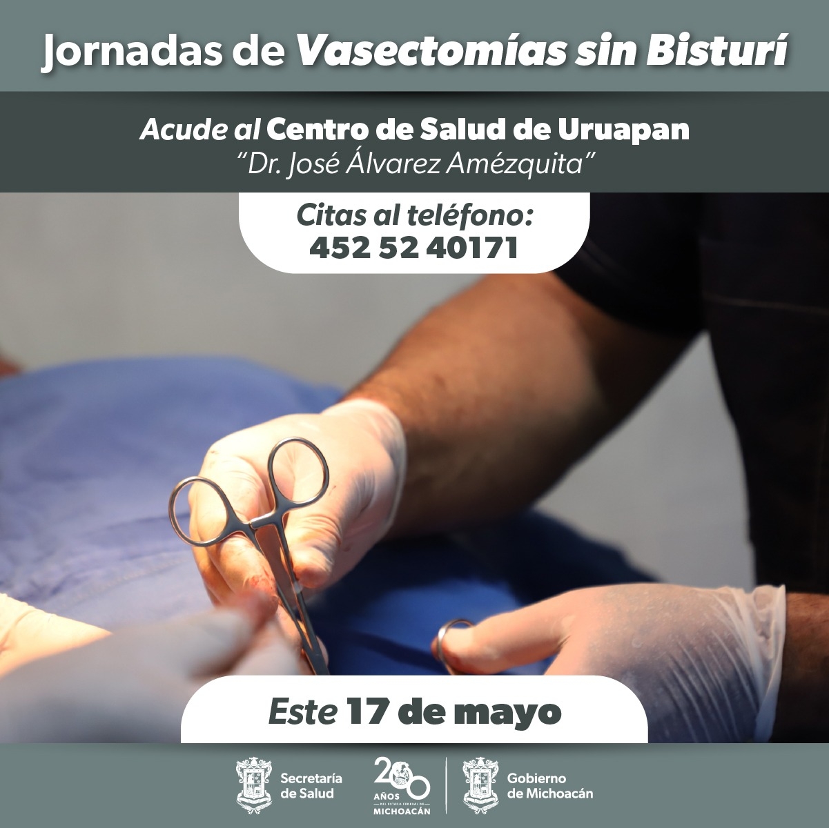 Segunda jornada de vasectomía sin bisturí gratuita en Uruapan